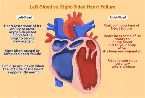 systolic left sided heart failure